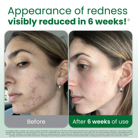 Clean_Skin_Club_Clean_Towels®_XL_Sensitive_Skin_|_Ultra-Soft_Disposable_Face_Towels_Infused_with_Aloe_&_Glycerin_|_Dermatologist-Approved_Towels_for_Sensitive_Skin,_Makeup_Remover_Dry_Wipes,_50_count