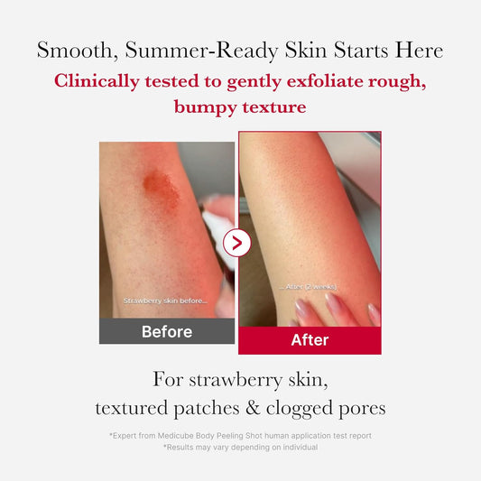 medicube_Red_Body_Peeling_Shot,_AHA_+_BHA_Exfoliating_Body_Spray_for_Summer-Ready_Smooth_Skin,_Treats_Strawberry_Skin,_Bumps_&_Breakouts,_3.88_oz