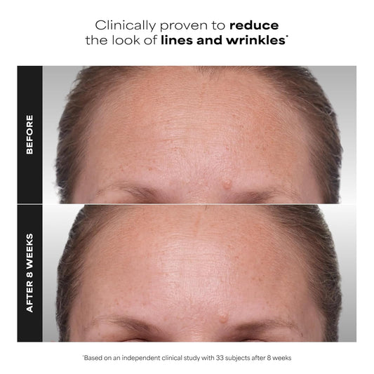 Paula's_Choice_CLINICAL_1%_Retinol_Face_Treatment_with_Peptides,_Vitamin_C_&_Licorice_Extract,_Anti-Aging_Skin_Care_Serum,_Fine_Lines_&_Wrinkles,_Fragrance_Free