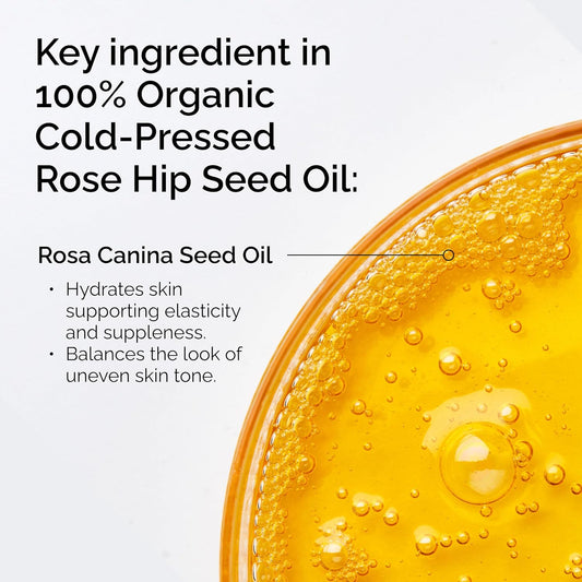The_Ordinary_100%_Organic_Cold-Pressed_Rose_Hip_Seed_Oil,_Addresses_Signs_of_Aging_by_Improving_the_Appearance_of_Uneven_Skin_Tone,_Supporting_Skin_Elasticity,_1_Fl_Oz
