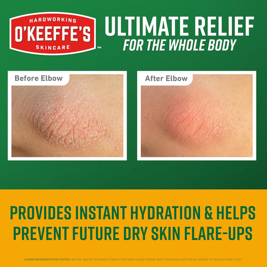 O’Keeffe’s_Skin_Repair_Ultimate_Relief_Body_Cream,_7oz_Tube_(Pack_of_1)_–_for_the_Most_Severe_Dry_Skin