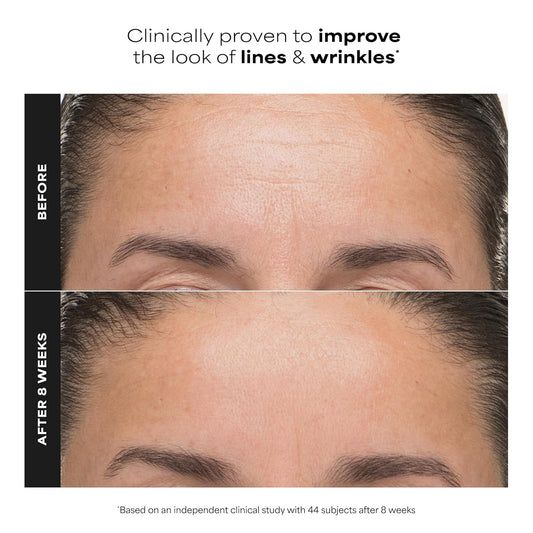 Paula’s_Choice_6%_Mandelic_Acid_+_2%_Lactic_Acid_Exfoliant,_Gentle_Daily_AHA_Exfoliation_for_Discoloration,_Bumpy_Texture_&_Radiance,_for_Sensitive_Skin,_Fragrance-Free