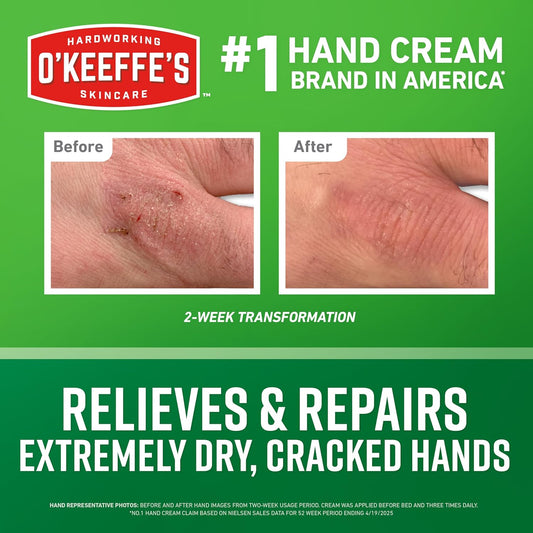 O'Keeffe's_Working_Hands_Hand_Cream_in_a_Pumpable_Jar_for_Extreme_Dryness_–_10oz_Pump_(1_Pack)_-_Repairing_Skincare_for_Cracked,_Dry_Hands