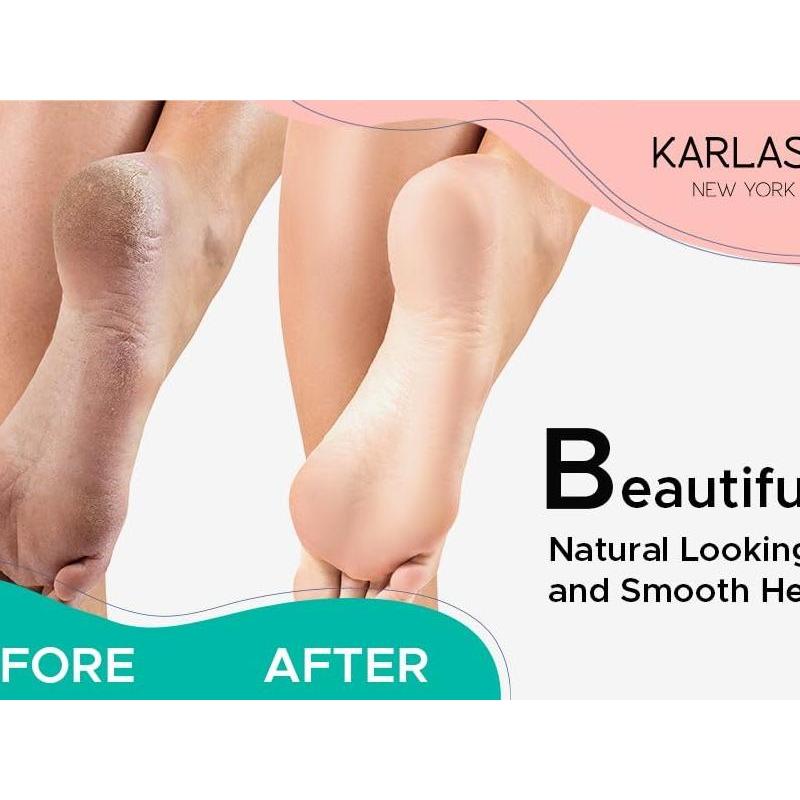 Professional_Best_Callus_Remover_Gel_for_Feet_and_Foot_Pumice_Stone_Scrubber_Kit_Remove_Hard_Skins_Heels_and_Tough_Callouses_from_feet_Quickly_and_Effortless_4_oz_(1_Bottle)