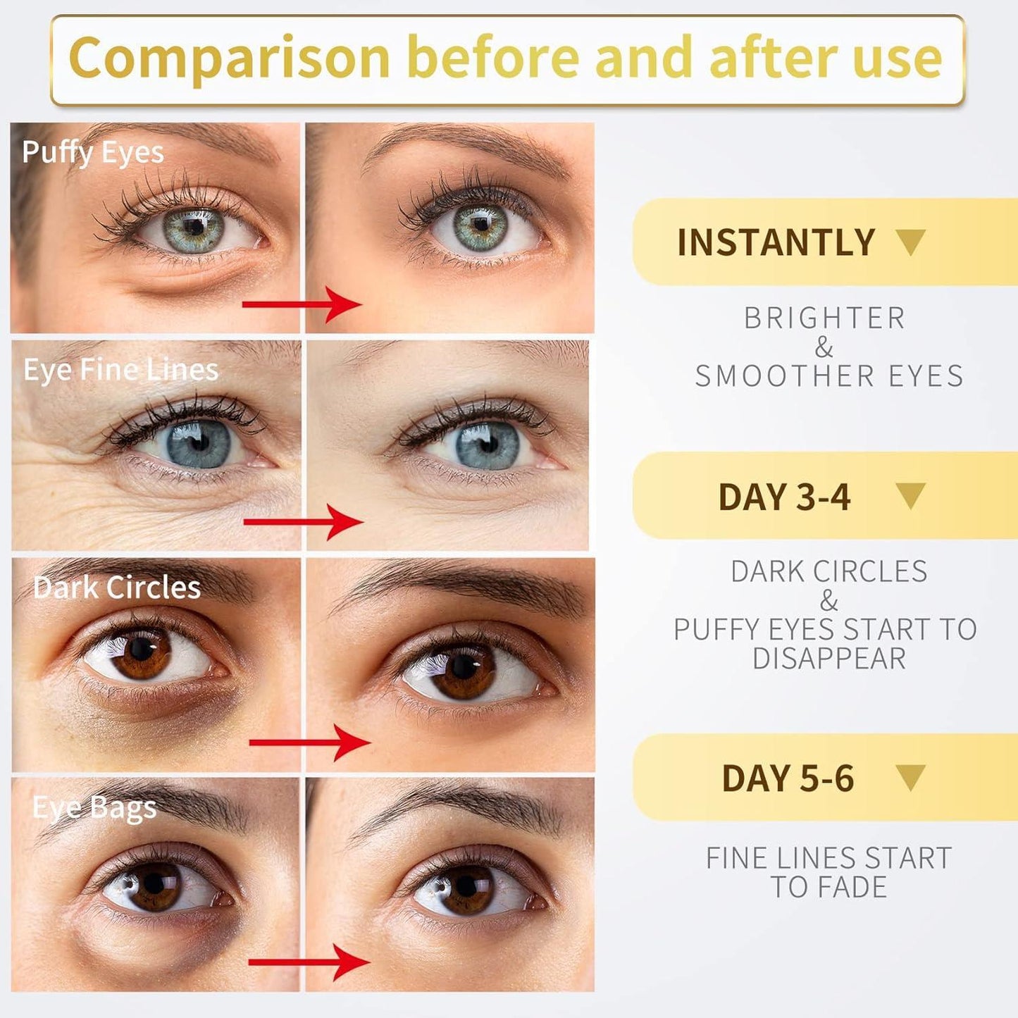 Under_Eye_Patches_-_60_Pcs_-_Gold_Eye_Mask-_Puffy_Eyes_&_Dark_Circles,_Under_Eye_Bags_and_Smooth_Wrinkles,_Eye_Skin_Care_Pads_With_Collagen,_Hyaluronic_Acid_&_Castor_Oil
