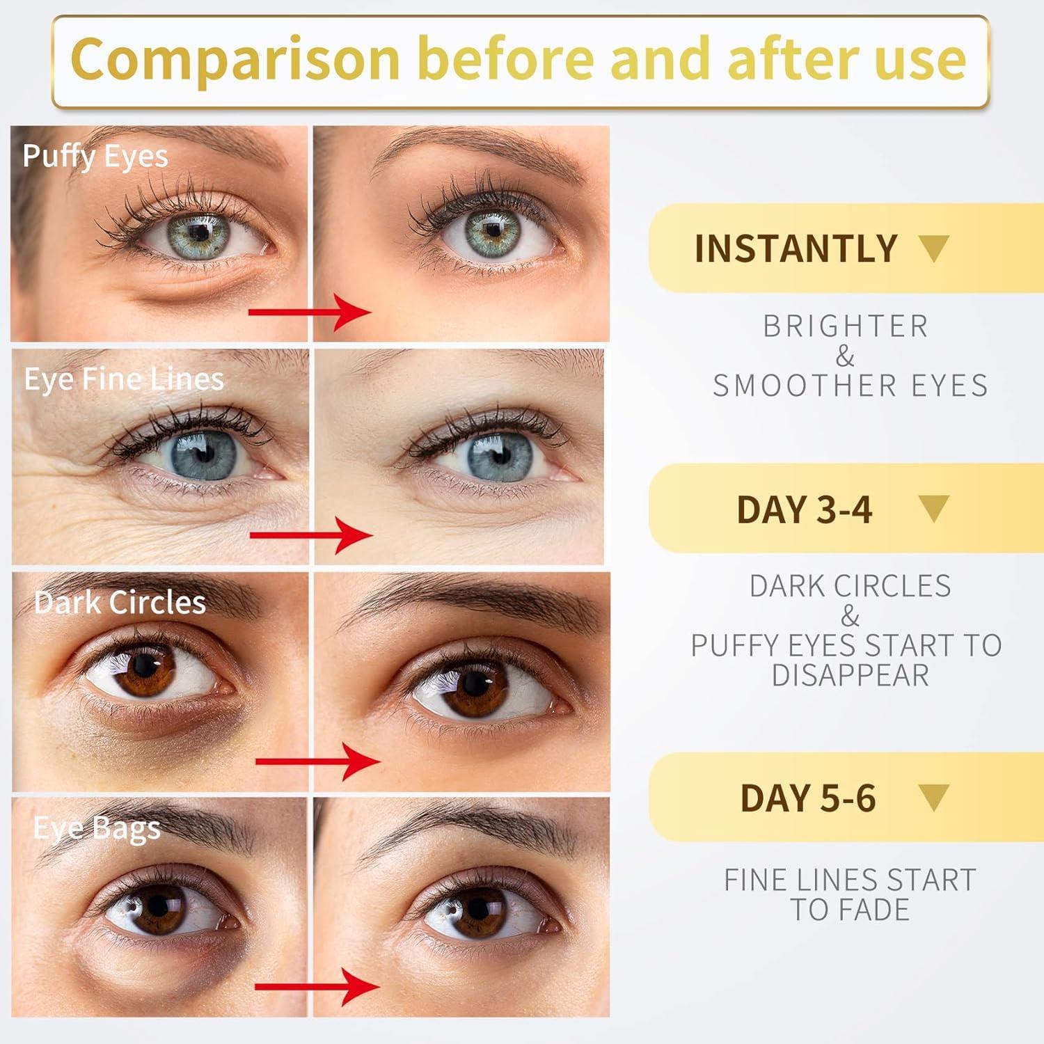 Under_Eye_Patches_-_60_Pcs_-_Gold_Eye_Mask-_Puffy_Eyes_&_Dark_Circles,_Under_Eye_Bags_and_Smooth_Wrinkles,_Eye_Skin_Care_Pads_With_Collagen,_Hyaluronic_Acid_&_Castor_Oil