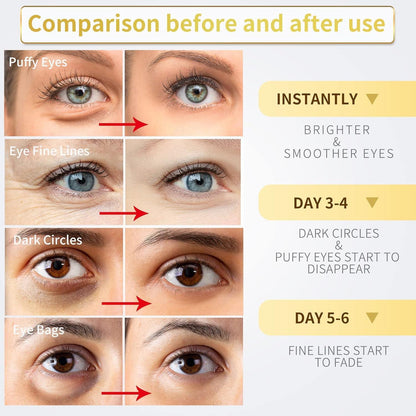 Under_Eye_Patches_-_60_Pcs_-_Gold_Eye_Mask-_Puffy_Eyes_&_Dark_Circles,_Under_Eye_Bags_and_Smooth_Wrinkles,_Eye_Skin_Care_Pads_With_Collagen,_Hyaluronic_Acid_&_Castor_Oil