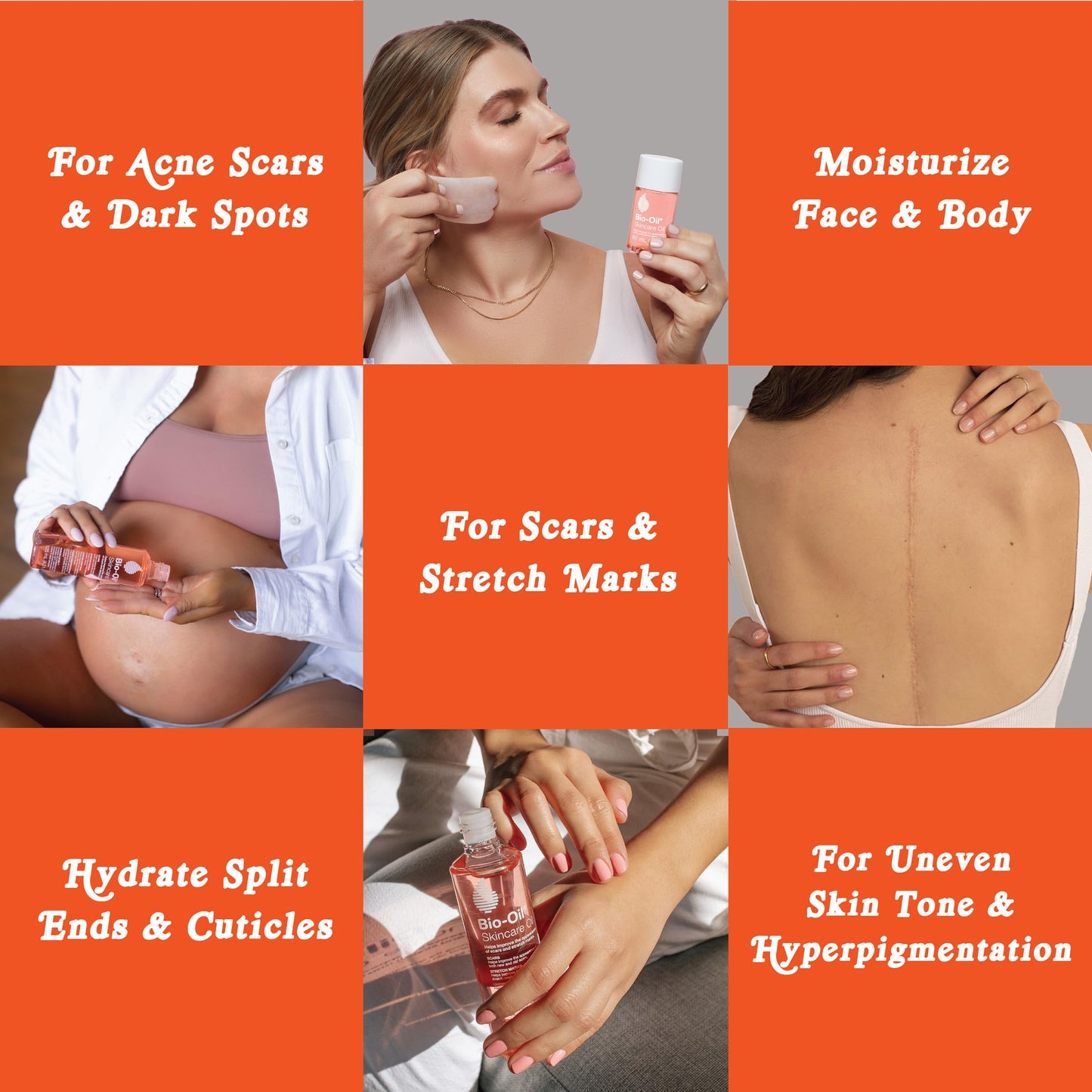 Bio-Oil_Skincare_Body_Oil,_Vitamin_E,_Serum_for_Scars_&_Stretchmarks,_Face_&_Body_Moisturizer,_2_oz,_All_Skin_Types