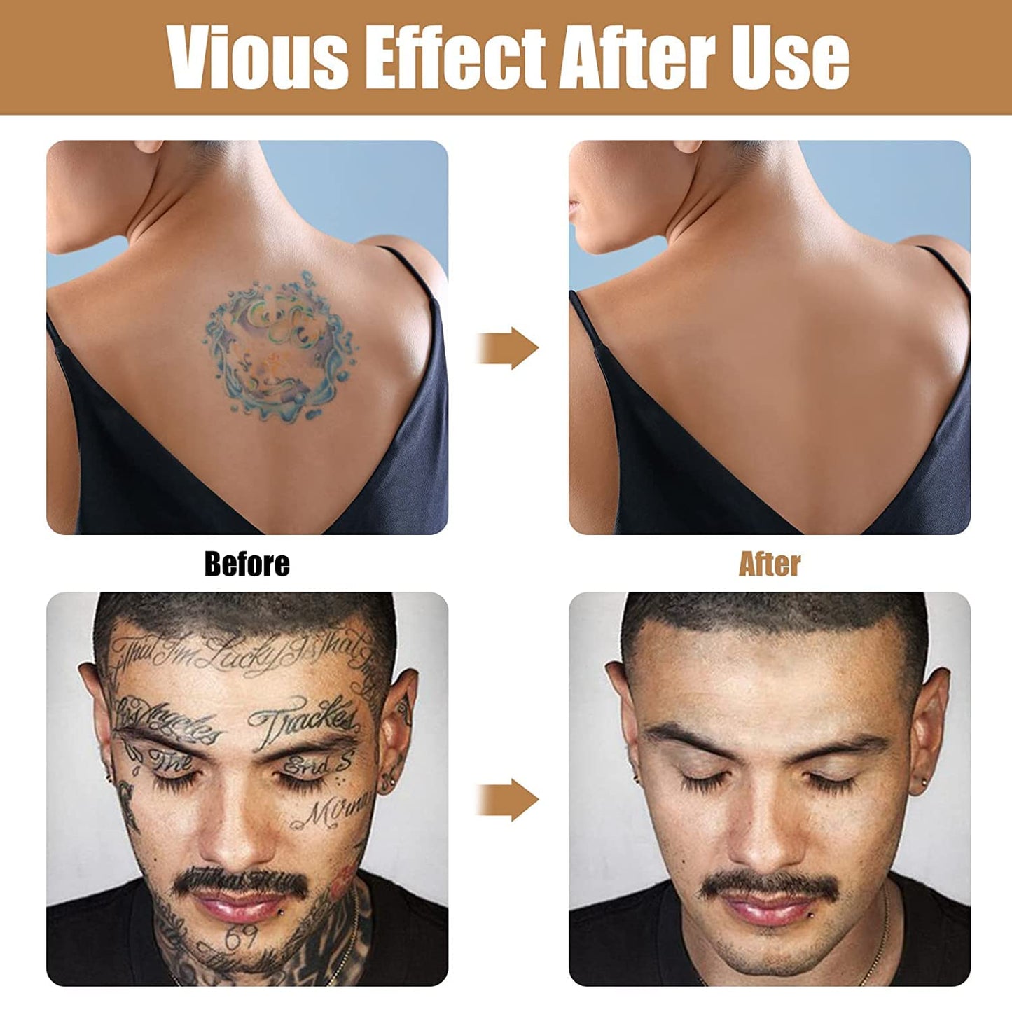 Tattoo_Cover_Up_Makeup_Waterproof,_Body_&_Leg_Scar_Concealer,_Suitable_for_Scars,_Dark_Spots,_Vitiligo,_2_Colors