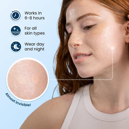 CLEAN_SKIN_CLUB_60_Invisible_Vegan_Pimple_Patches,_Derma_Dot_Hydrocolloid_for_Covering_Zits,_Blackhead,_Blemish,_Absorbing_Face_Cover_Sticker,_Skincare_Treatment,_Non_Toxic_Ingredients