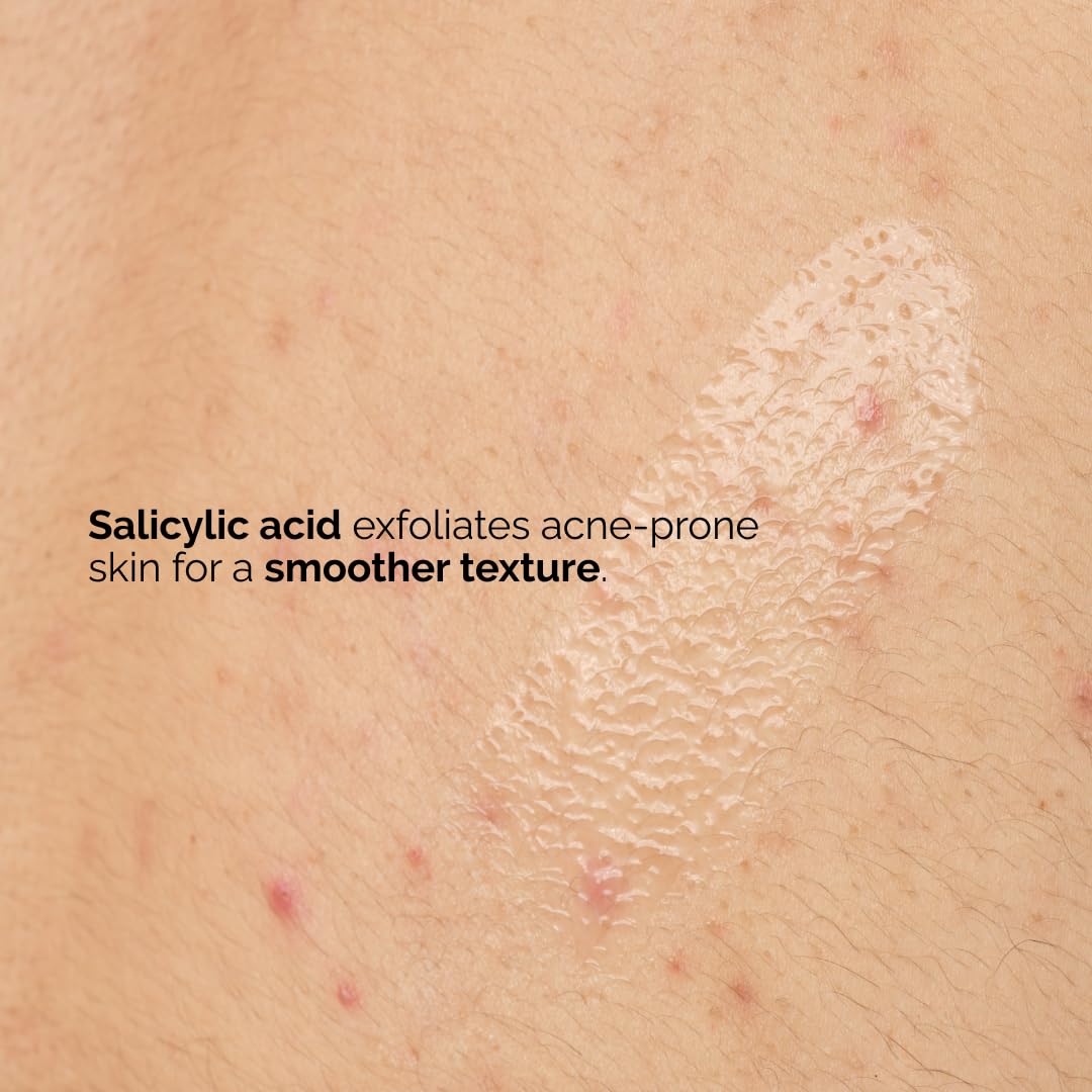 The_Ordinary_Salicylic_Acid_0.5%_Body_Serum,_Exfoliating_Treatment_for_Acne-Prone_Skin,_8.1_Fl_Oz