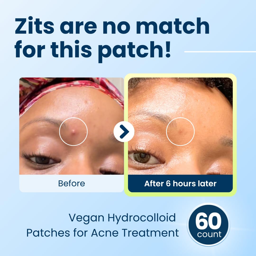 CLEAN_SKIN_CLUB_60_Invisible_Vegan_Pimple_Patches,_Derma_Dot_Hydrocolloid_for_Covering_Zits,_Blackhead,_Blemish,_Absorbing_Face_Cover_Sticker,_Skincare_Treatment,_Non_Toxic_Ingredients