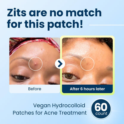 CLEAN_SKIN_CLUB_60_Invisible_Vegan_Pimple_Patches,_Derma_Dot_Hydrocolloid_for_Covering_Zits,_Blackhead,_Blemish,_Absorbing_Face_Cover_Sticker,_Skincare_Treatment,_Non_Toxic_Ingredients