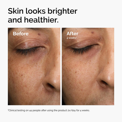 The_Ordinary_Multi-Antioxidant_Radiance_Serum,_Vitamin_C_Serum_For_Face,_Brighten_&_Protect_Skin_–_Boosts_Glow_&_Shields_Against_Environmental_Stressors,_1_Fl_Oz