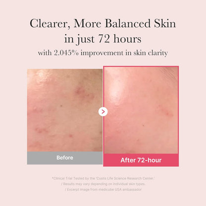 medicube_TXA+Niacinamide_15%_Glow_Facial_Serum_for_After_Spot_Care_|_All-in-One_Daily_Korean_Skincare_|_Uneven_Skin_Tone,_Texture,_and_Hydration_Care_|_High-Potency_Tranexamic_Acid_5%_|_1.01_fl.oz