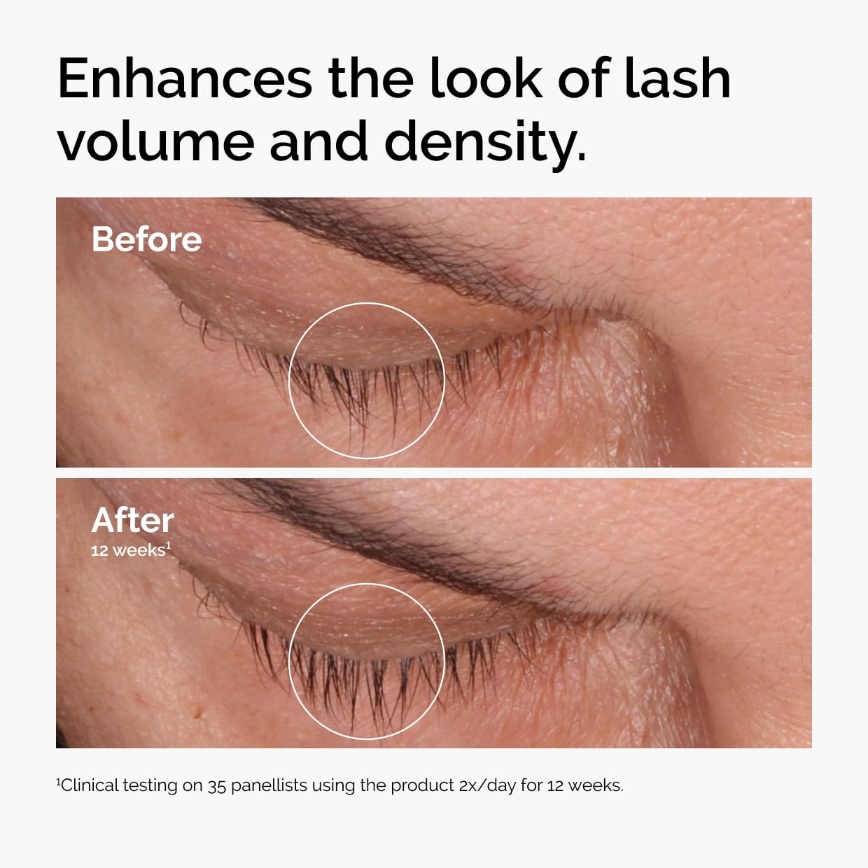 The_Ordinary_Multi-Peptide_Lash_and_Brow_Serum,_Peptide-Powered_Formula_for_Thicker,_Fuller_Looking_Lashes_&_Brows