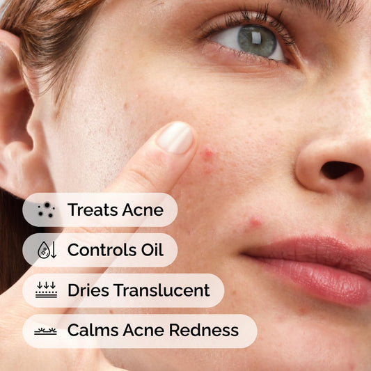 The_Ordinary_Sulfur_10%_Powder-to-Cream_Acne_Spot_Treatment_Concentrate,_Reduces_Pimple_Size_and_Zit_Redness,_0.18_Oz