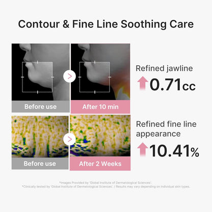 medicube_PDRN_Pink_Tension_Up_Mask_|_3-Step_V-line_Mask_for_Contoured-Looking_Chin_&_Jawline_|_Full-Face_Firming_Care_with_Salmon_PDRN,_NAD_&_Caffeine_|_Korean_Skincare,_34g_x_4ea_+_Tightening_Band