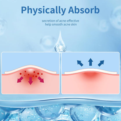 Pimple_Patches_for_Face,_4_Size_300_Counts_Acne_Patches,_Hydrocolloid_Patches_for_Covering_Zits_and_Blemishes,_Spot_Stickers_with_Salicylic_Acid,_Tea_Tree_Oil_&_Calendula_Oil
