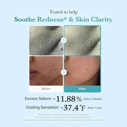 medicube_Azelaic_Acid_Niacinamide_Clarifying_Toner_|_Troubled_Skin_Care,_Ideal_for_Purifying_&_Calming_|_4%_Azelaic_Acid_&_2%_Niacinamide|_Soothing_Daily_Toner_|_Korean_Skin_Care_|_8.45_fl.oz