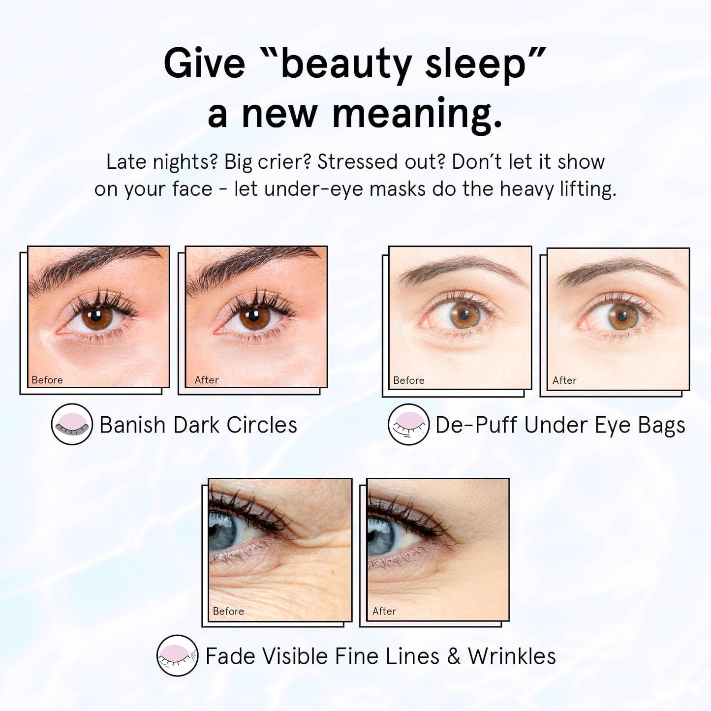 grace_&_stella_Retinol_Under_Eye_Patches_for_Puffy_Eyes_&_Dark_Circles_-_Restoring_Gel_Under_Eye_Masks_with_Hyaluronic_Acid_-_Bridesmaid_Gifts,_Birthday_Gifts_for_Women_(Purple,_24_Pairs)
