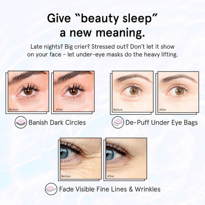 grace_&_stella_Retinol_Under_Eye_Patches_for_Puffy_Eyes_&_Dark_Circles_-_Restoring_Gel_Under_Eye_Masks_with_Hyaluronic_Acid_-_Bridesmaid_Gifts,_Birthday_Gifts_for_Women_(Purple,_24_Pairs)