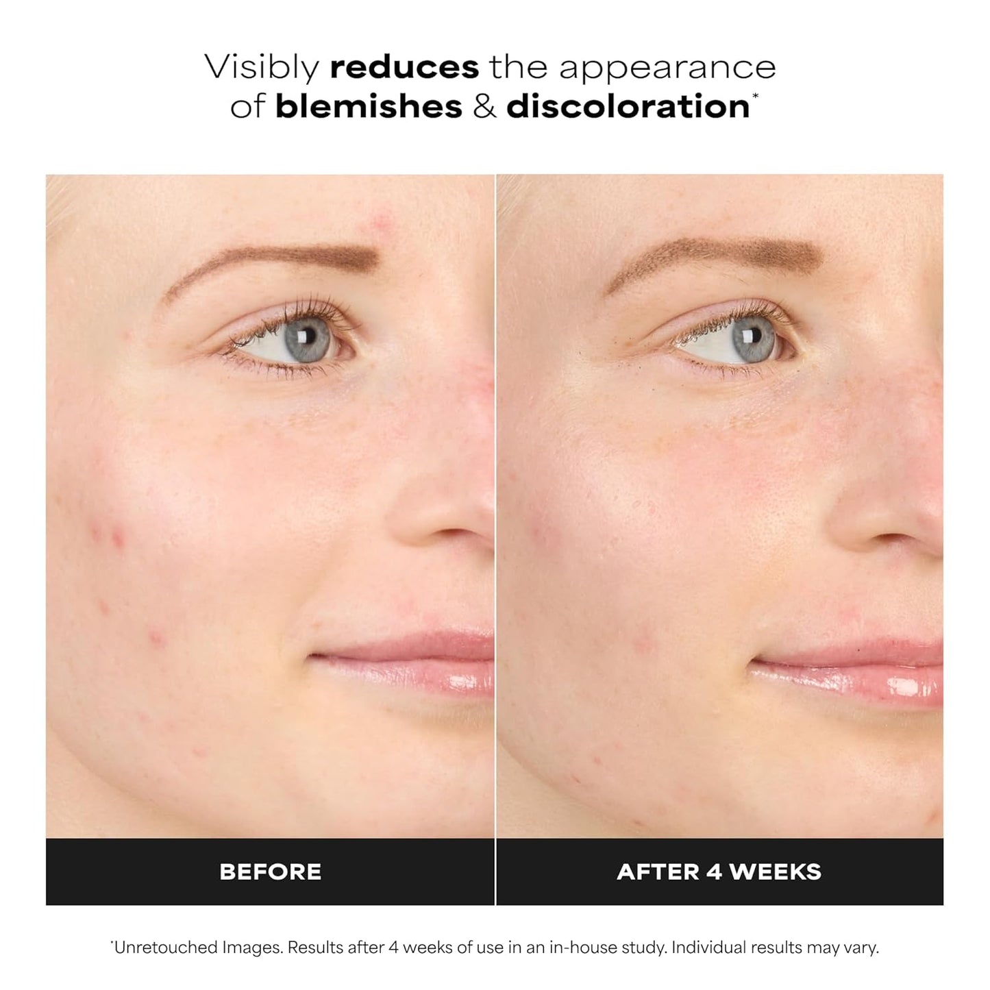 Paula's_Choice_BOOST_10%_Azelaic_Acid_Booster_Cream_Gel_Face_Serum_with_Salicylic_Acid,_Oil-Free_Skin_Brightening_Serum_for_Face,_Fragrance-Free