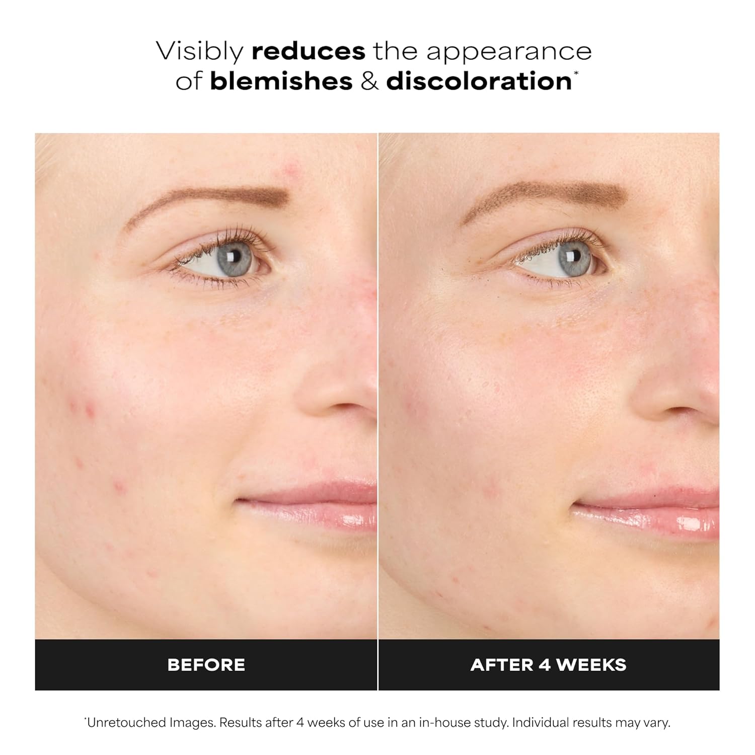 Paula's_Choice_BOOST_10%_Azelaic_Acid_Booster_Cream_Gel_Face_Serum_with_Salicylic_Acid,_Oil-Free_Skin_Brightening_Serum_for_Face,_Fragrance-Free