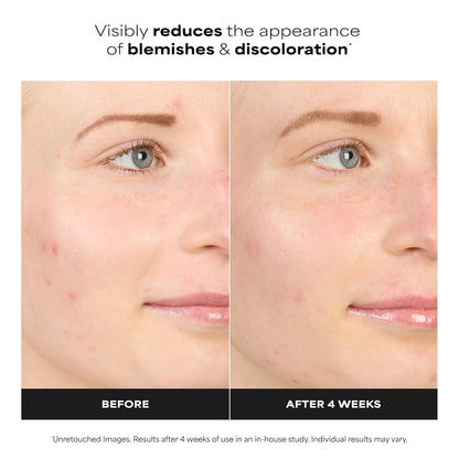Paula's_Choice_BOOST_10%_Azelaic_Acid_Booster_Cream_Gel_Face_Serum_with_Salicylic_Acid,_Oil-Free_Skin_Brightening_Serum_for_Face,_Fragrance-Free