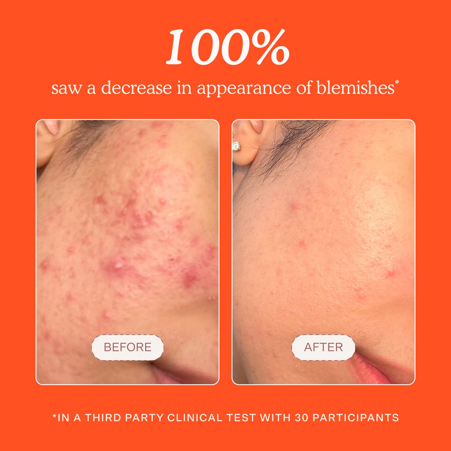 Tower_28_SOS_Daily_Rescue_Facial_Spray_-_Hypochlorous_Acid_Spray_to_Help_Reduce_Redness,_Calm_Irritation_+_Alleviate_Flare-Ups_-_Soothing_+_Purifying_Face_Toner_-_Everyday_Skin_Care_Essential_(4_oz)