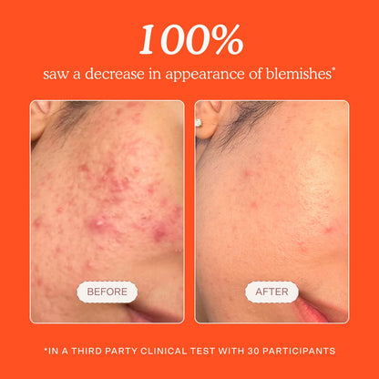 Tower_28_SOS_Daily_Rescue_Facial_Spray_-_Hypochlorous_Acid_Spray_to_Help_Reduce_Redness,_Calm_Irritation_+_Alleviate_Flare-Ups_-_Soothing_+_Purifying_Face_Toner_-_Everyday_Skin_Care_Essential_(4_oz)