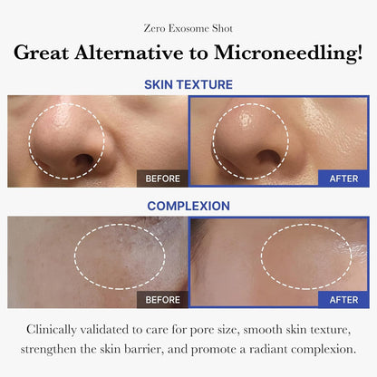medicube_Exosome_Shot_Zero_2,000_PPM_Spicule_Facial_Serum_|_Liquid_Skin_Booster_Serum_|_Exosome,_AHA+BHA+PHA_|_Pore_Care,_Dead_Skin_Cells,_Skin_Texture_|_Korean_Skincare,_1.01_fl.oz