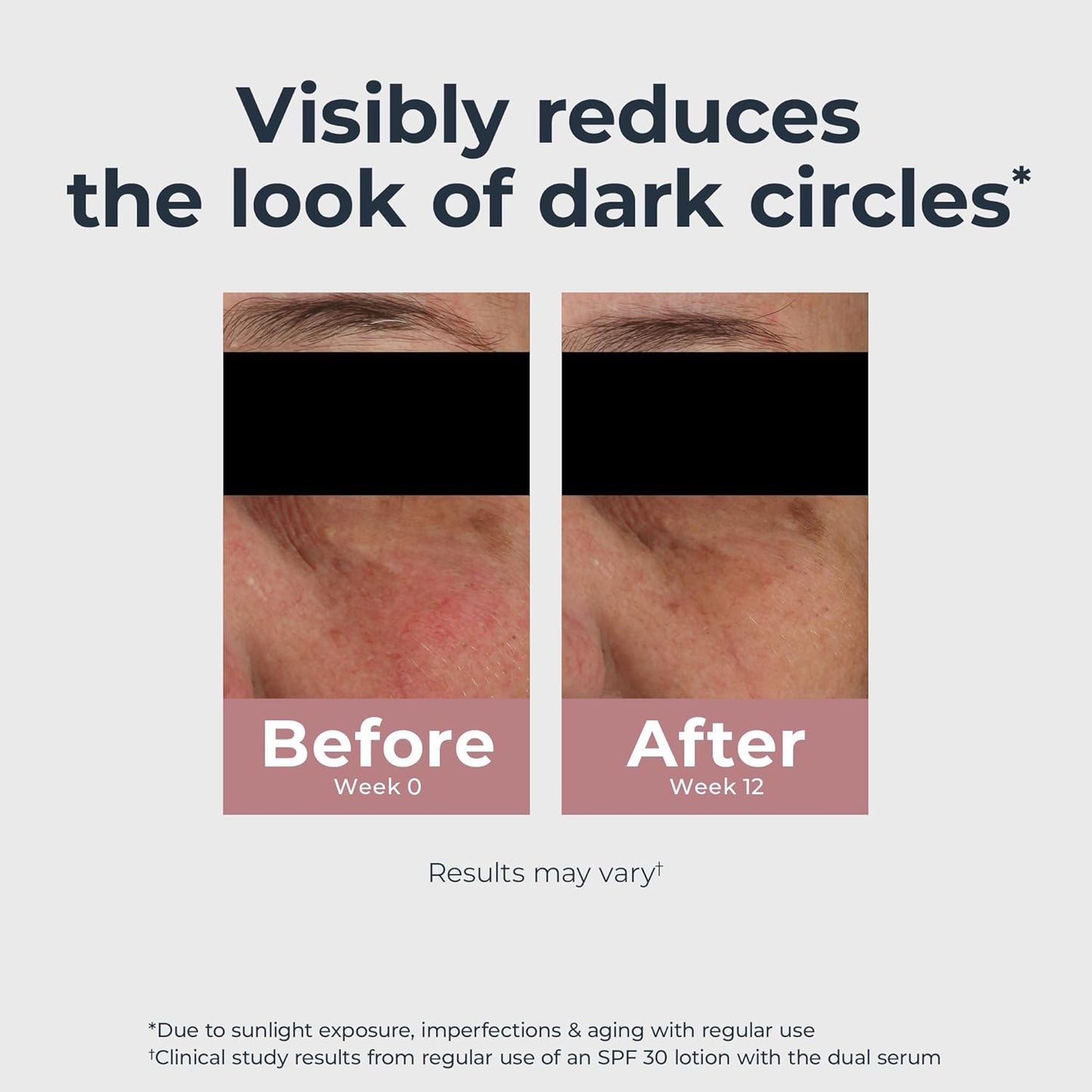 Eucerin_Radiant_Tone_Eye_Cream_Dark_Circle_Corrector,_Eye_Brightening_Cream_with_Thiamidol_and_Hyaluronic_Acid,_Helps_Reduce_the_Look_of_Eye_Puffiness,_0.5_Oz_Tube
