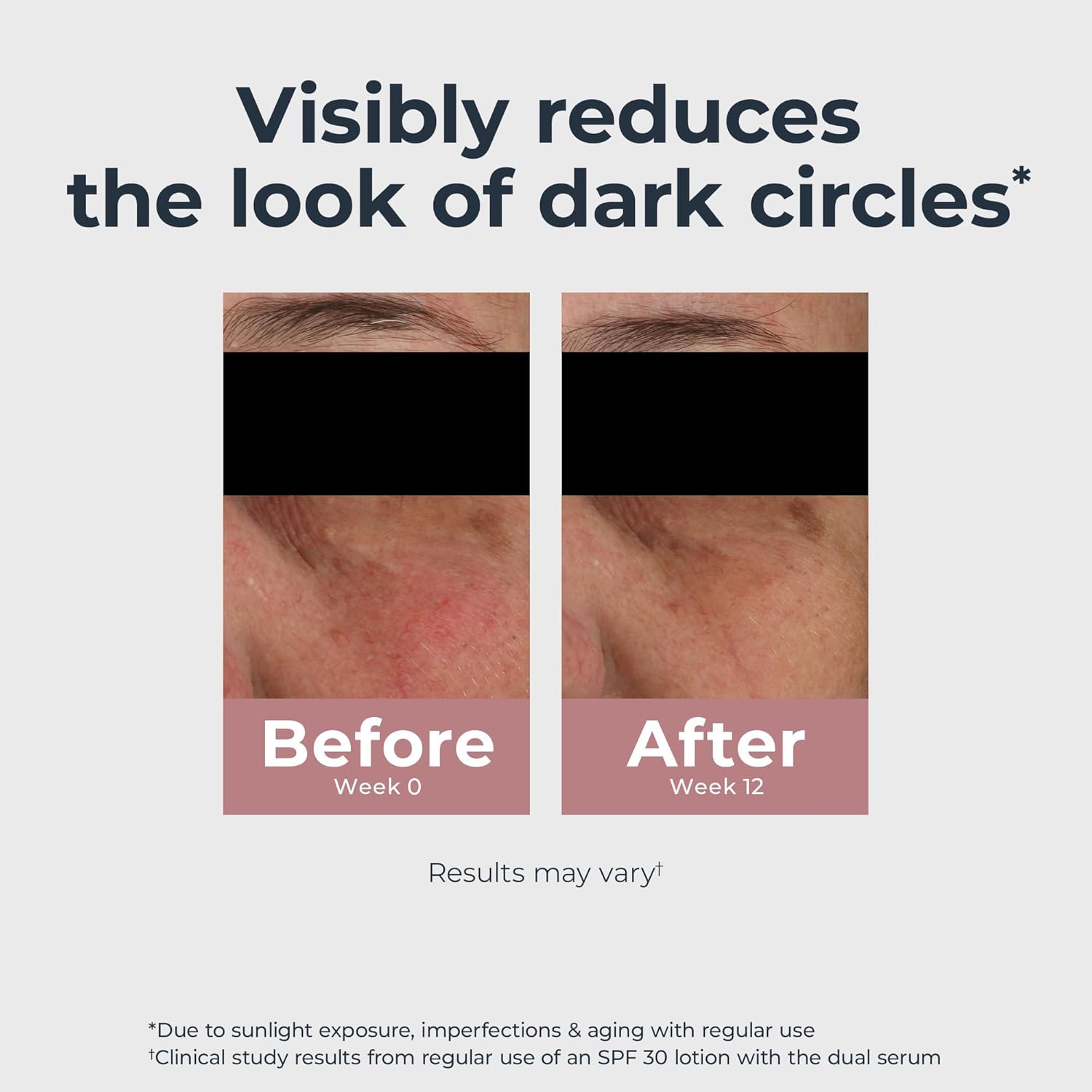 Eucerin_Radiant_Tone_Eye_Cream_Dark_Circle_Corrector,_Eye_Brightening_Cream_with_Thiamidol_and_Hyaluronic_Acid,_Helps_Reduce_the_Look_of_Eye_Puffiness,_0.5_Oz_Tube