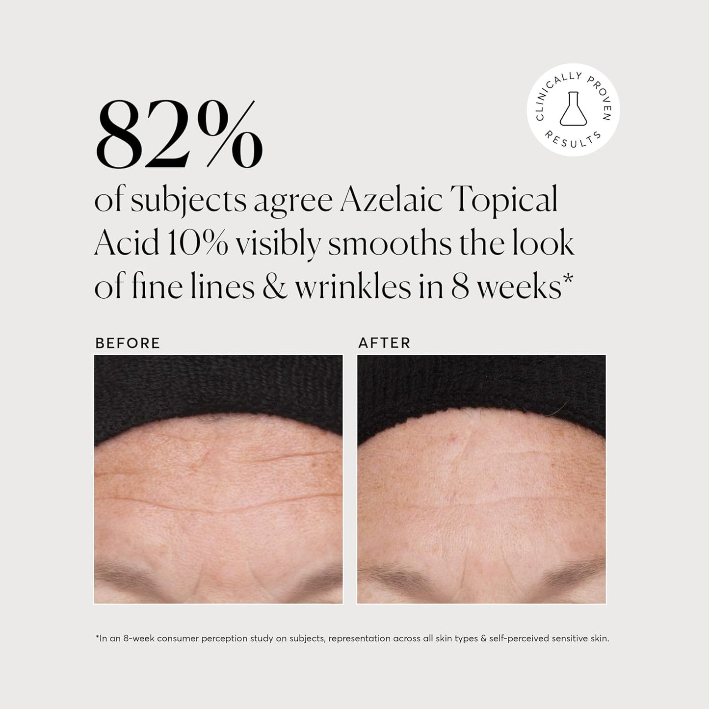 Naturium_Azelaic_Topical_Acid_10%,_Face_&_Skin_Care_Beauty_Treatment_with_Niacinamide_&_Vitamin_C,_1_oz