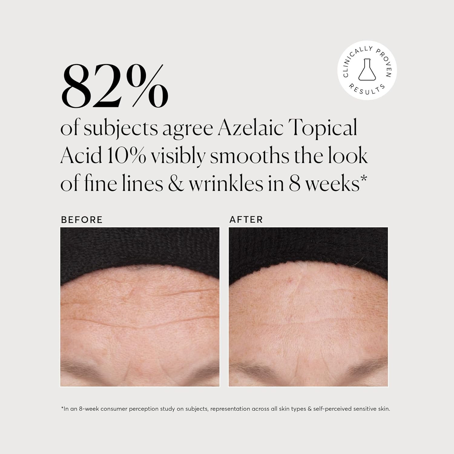 Naturium_Azelaic_Topical_Acid_10%,_Face_&_Skin_Care_Beauty_Treatment_with_Niacinamide_&_Vitamin_C,_1_oz