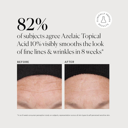 Naturium_Azelaic_Topical_Acid_10%,_Face_&_Skin_Care_Beauty_Treatment_with_Niacinamide_&_Vitamin_C,_1_oz