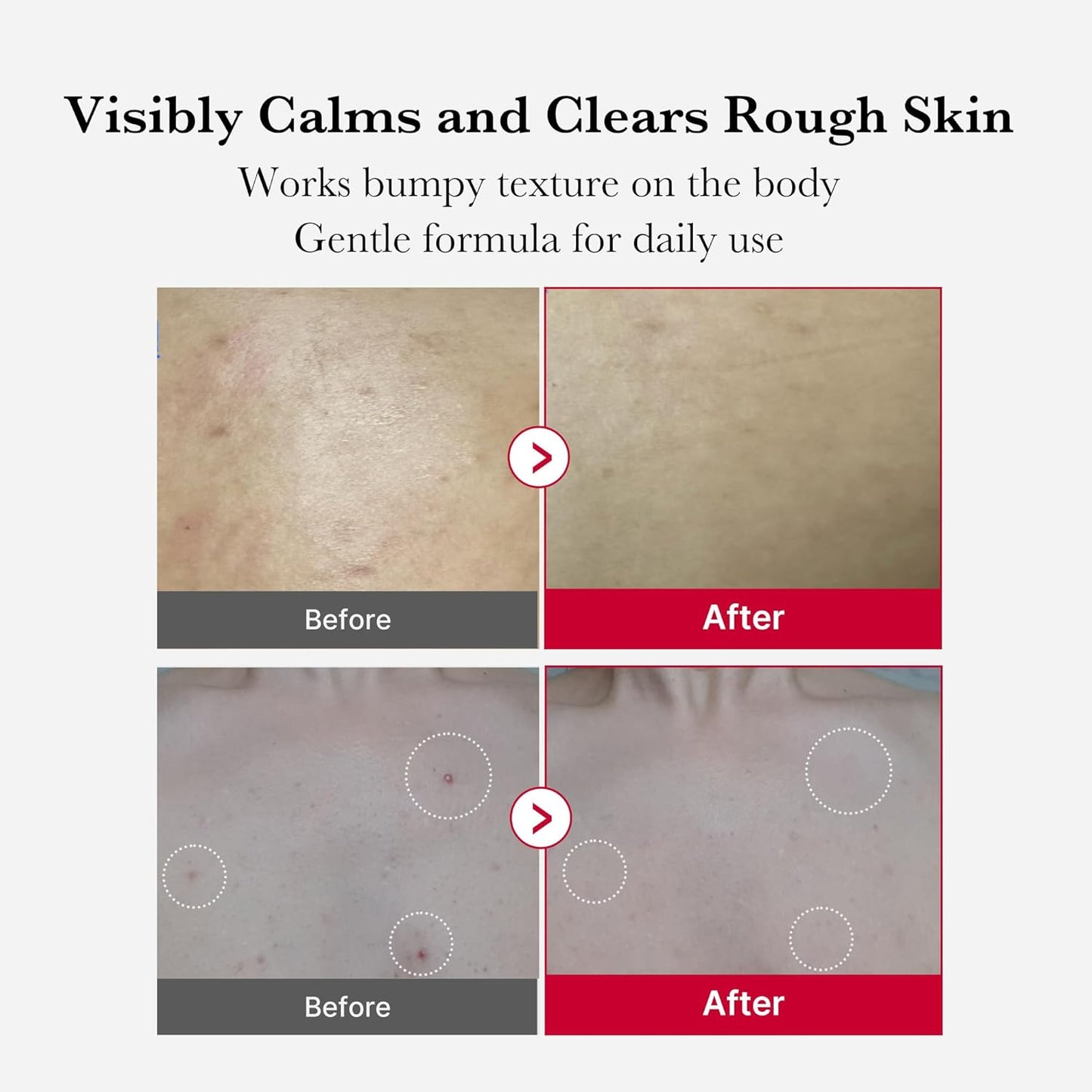 medicube_Red_Body_Peeling_Shot,_AHA_+_BHA_Exfoliating_Body_Spray_for_Summer-Ready_Smooth_Skin,_Treats_Strawberry_Skin,_Bumps_&_Breakouts,_3.88_oz