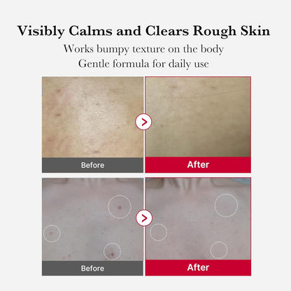 medicube_Red_Body_Peeling_Shot,_AHA_+_BHA_Exfoliating_Body_Spray_for_Summer-Ready_Smooth_Skin,_Treats_Strawberry_Skin,_Bumps_&_Breakouts,_3.88_oz