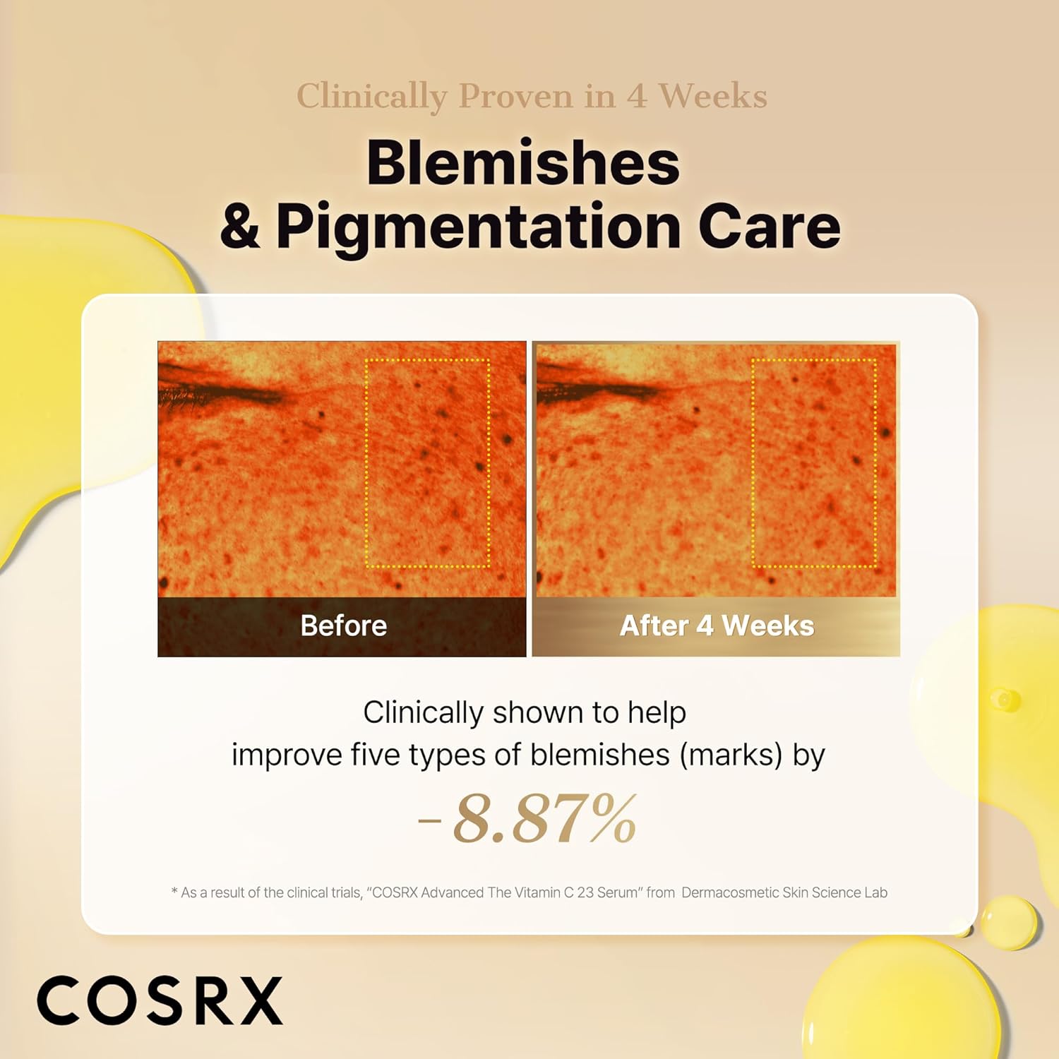COSRX_Advanced_Pure_Vitamin_C_23%_Serum_with_Vitamin_E_&_Glutathione,_Korean_Vitamin_C_Serum_for_Fine_Lines,_Uneven_Skin_Tone_&_Dull_Skin,_0.7oz,_Korean_Skin_Care,_Mothers_Day_Gifts_for_Mom_&_Wife