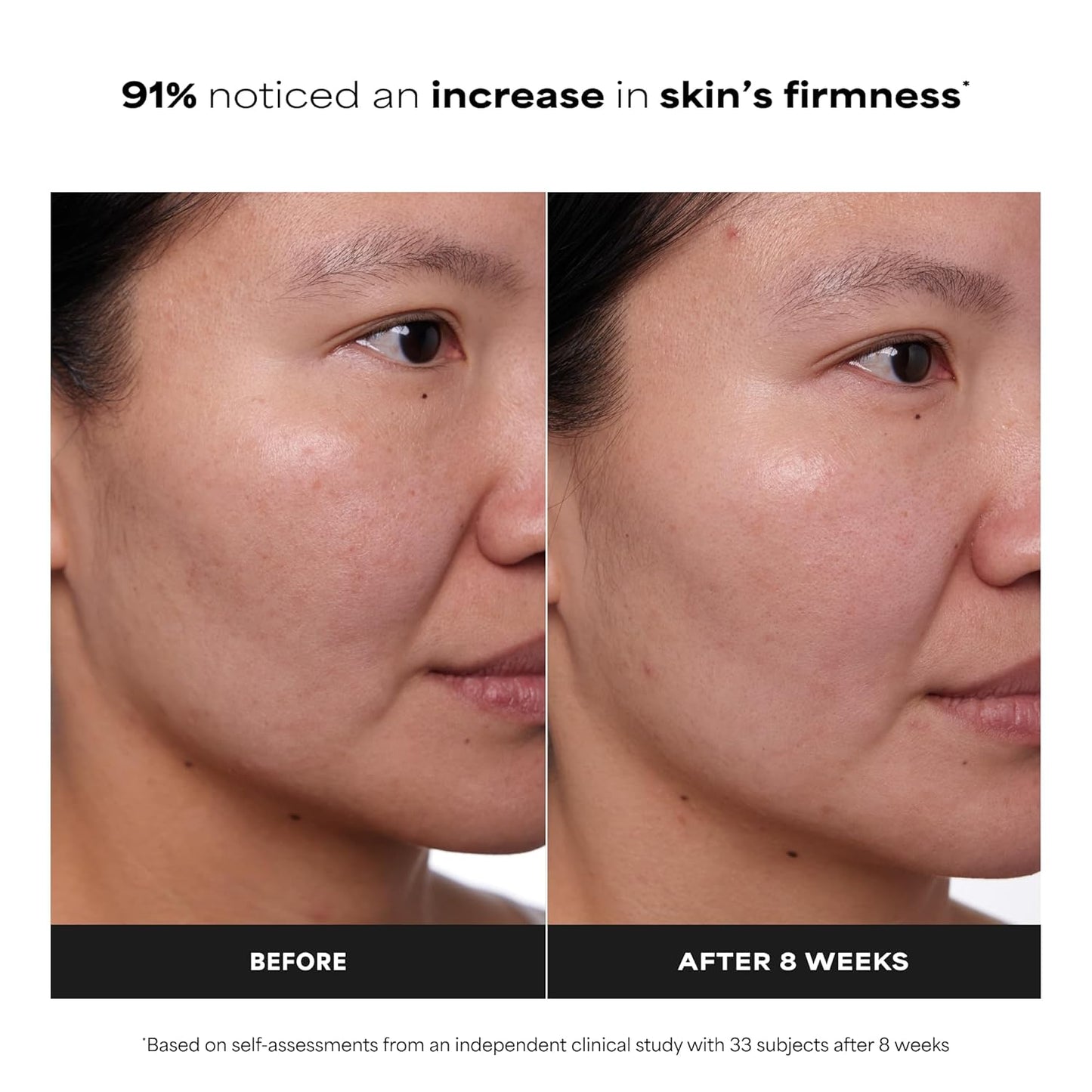 Paula's_Choice_CLINICAL_1%_Retinol_Face_Treatment_with_Peptides,_Vitamin_C_&_Licorice_Extract,_Anti-Aging_Skin_Care_Serum,_Fine_Lines_&_Wrinkles,_Fragrance_Free