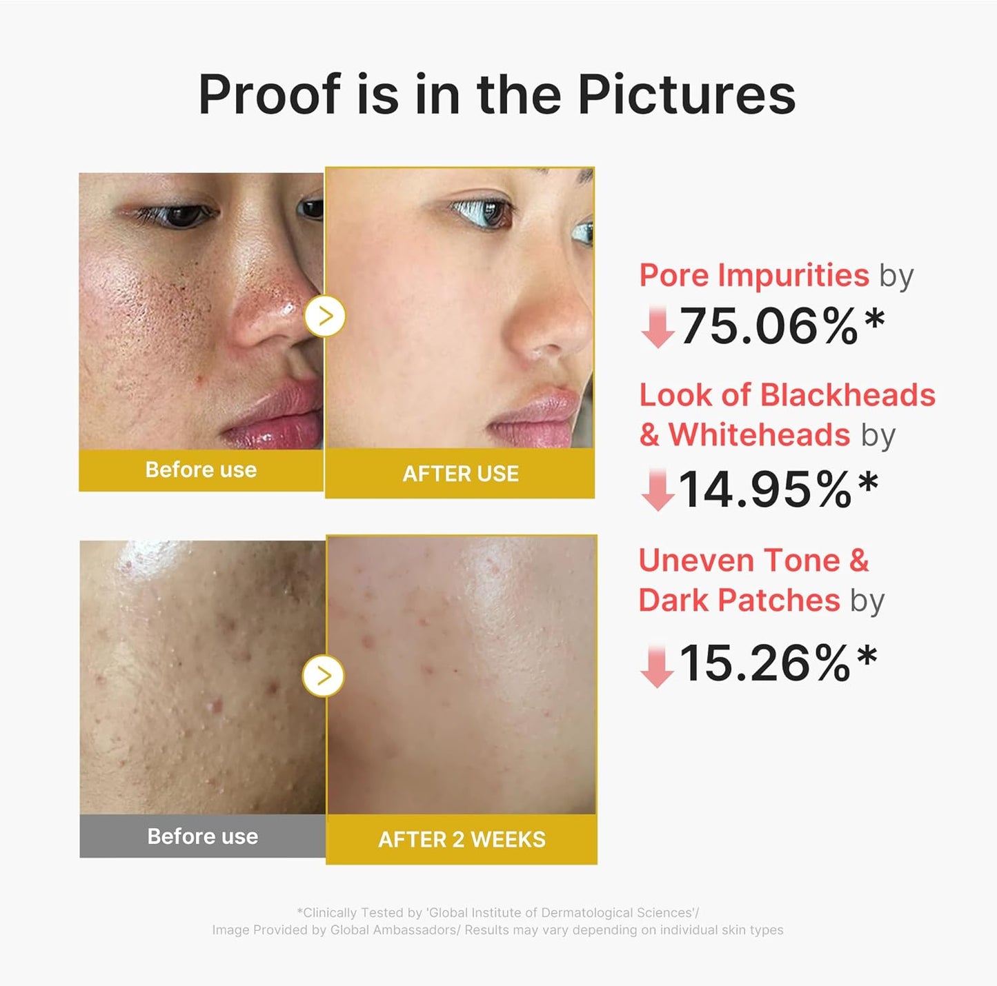 medicube_Peel_Shot_with_Kojic_Acid_Turmeric_|_Reset_in_One_Step_|_Gentle_Exfoliating_Serum_with_BHA,_LHA,_PHA_for_Dead_Skin_Cells,_Blackheads,_Excess_Sebum_|_For_Dull,_Rough,_Troubled_Skin_|_2.7_fl.oz