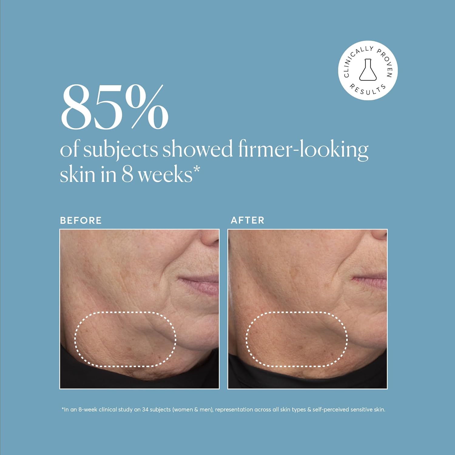 Naturium_Retinol_Complex_Serum,_Encapsulated_Retinols_&_Bakuchiol,_Refining_&_Smoothing_Facial_Serum,_1_oz