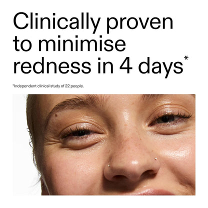 The_INKEY_List_SuperSolutions_Azelaic_Acid_10%_Serum,_Fast-Absorbing_Formula_Helps_Reduce_Appearance_of_Redness_and_Soothes_Skin,_Leaves_No_White_Cast,_1.01_fl_oz
