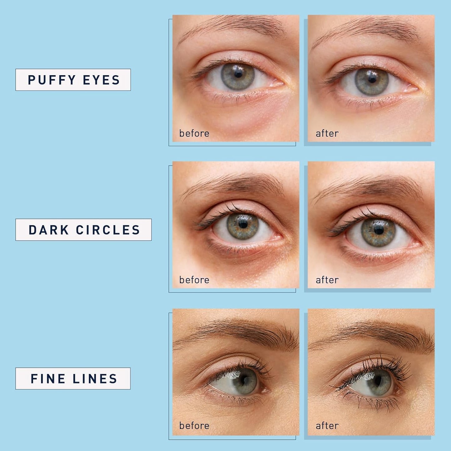 Enaskin_Naturals_Under_Eye_Patches_for_Dark_Circles:_30_Pairs_Retinol_Collagen_Eye_Gels_Mask_-_Reduce_Wrinkles_Puffy_&_Bags_-_Skin_Treatment_Pads_-_Anti_Aging_Moisturizer_For_Women_(Blue)