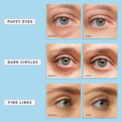 Enaskin_Naturals_Under_Eye_Patches_for_Dark_Circles:_30_Pairs_Retinol_Collagen_Eye_Gels_Mask_-_Reduce_Wrinkles_Puffy_&_Bags_-_Skin_Treatment_Pads_-_Anti_Aging_Moisturizer_For_Women_(Blue)