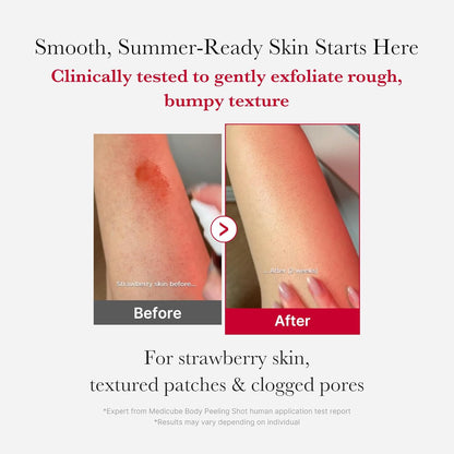 medicube_Red_Body_Peeling_Shot,_AHA_+_BHA_Exfoliating_Body_Spray_for_Summer-Ready_Smooth_Skin,_Treats_Strawberry_Skin,_Bumps_&_Breakouts,_3.88_oz