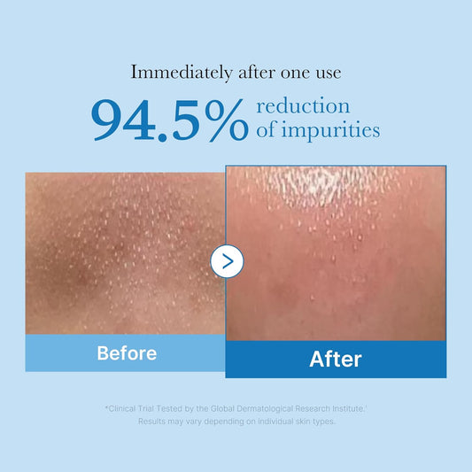 medicube_Zero_Pore_Blackhead_Cleansing_Oil_|_Makeup_Remover_for_all_skin_types,_Daily_Moisture_Facial_Cleanser,_Low-Irritation_|_Korean_Skin_Care_(205ml_/_6.93_fl.oz)