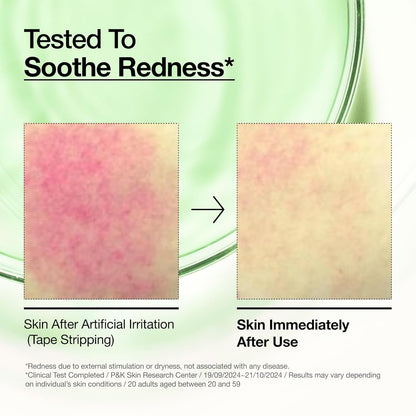 Anua_Azelaic_Acid_10_Hyaluron_Redness_Soothing_Serum,_Facial_Serum_for_Blemish-Prone_&_Oily-Prone_Skin,_Lightweight_&_Hydrating_Blemish_Care,_Hyaluronic_Acid,_Korean_Skincare,_1.01_fl_oz.
