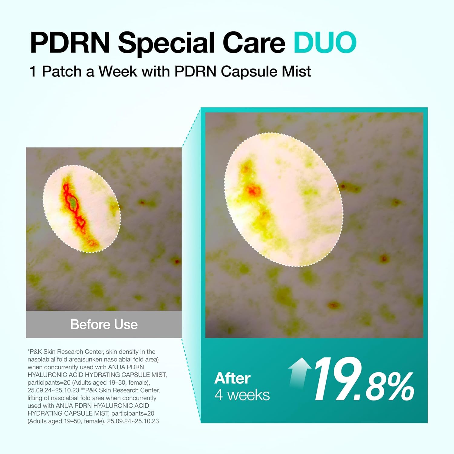 ANUA_Salmon_DNA_PDRN_Collagen_Melting_Patch_for_Glass_skin,_Smile_Line_Patches,_Wrinkle_Patches,_Melting_Thin_Collagen_Patch,_Firming_for_Fine_Lines,_Glow,_Korean_Skincare,_2_Pairs_x_4EA,_Patch_Only